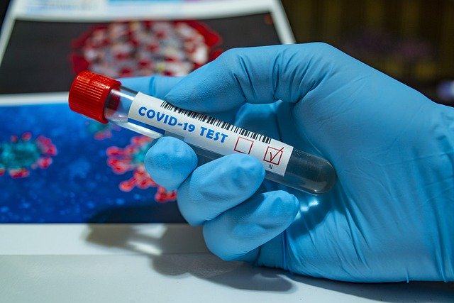 В каких случаях североказахстанцы могут сдать анализ на коронавирус в поликлинике бесплатно