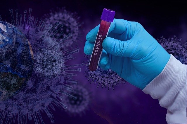 Из резерва Правительства выделили деньги для тестирования казахстанцев на коронавирус