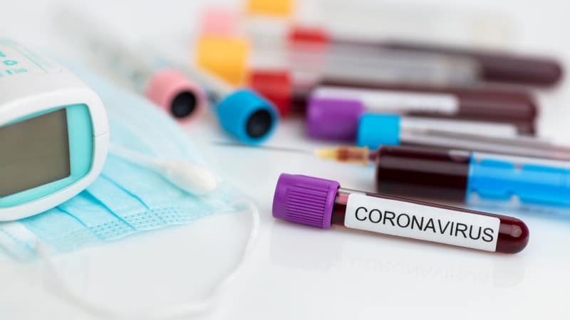 Ситуация с коронавирусом в районах Северо-Казахстанской области на 20 января 2021 года