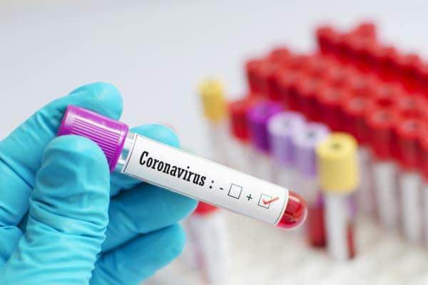 У североказахстанцев 10 районов из возможных 13 диагностировали коронавирус