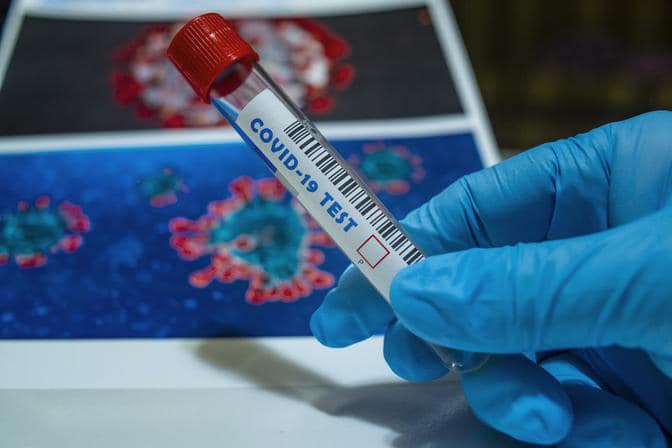У жителей четырёх районов на севере Казахстана выявили коронавирус за минувши�